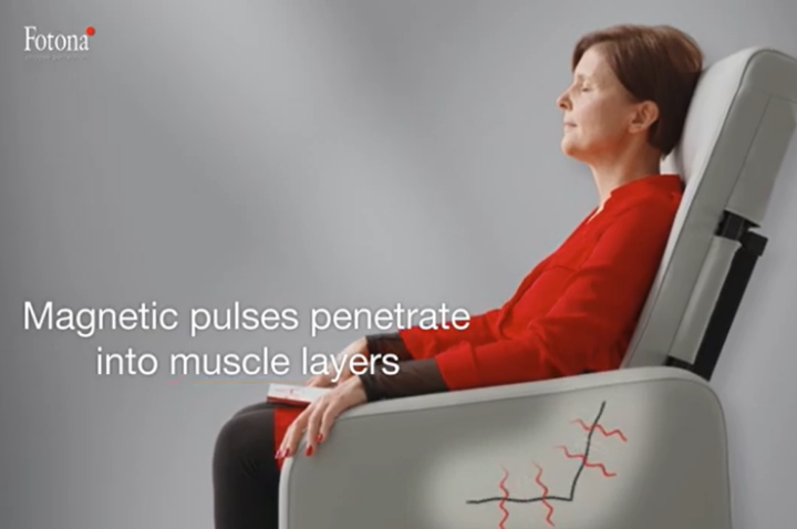 タイトウェーブ®治療